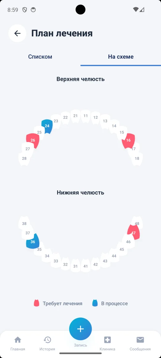 Зубная карта